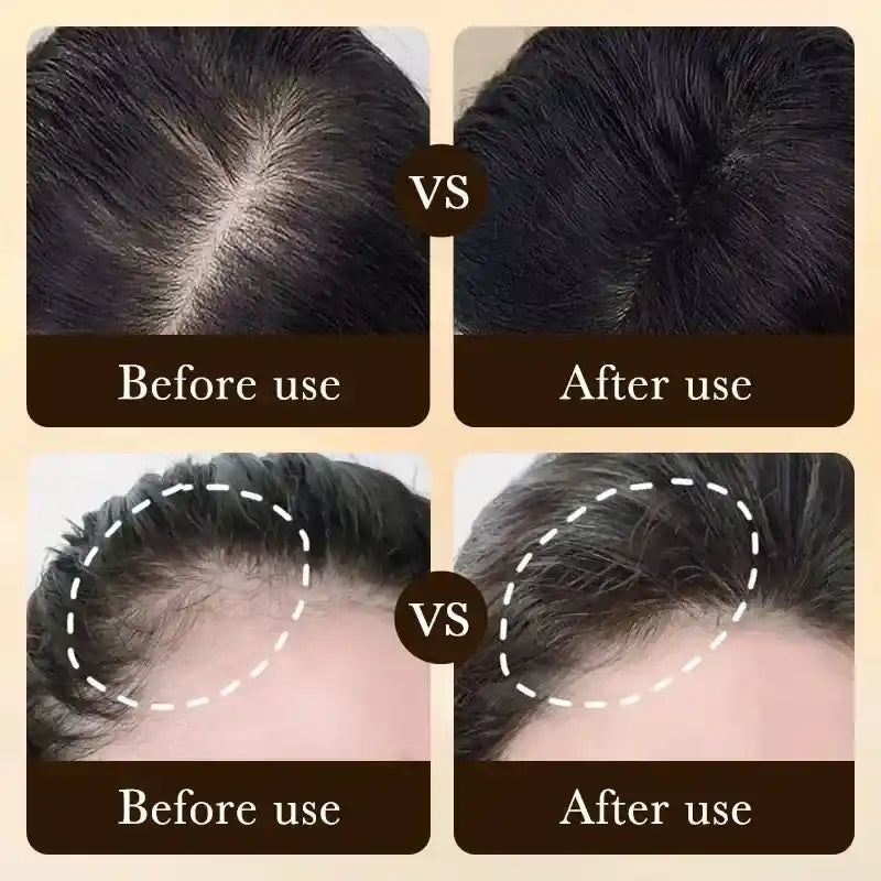 ¡Deja de Sufrir por la Caída del Cabello y Recupera tu Confianza!